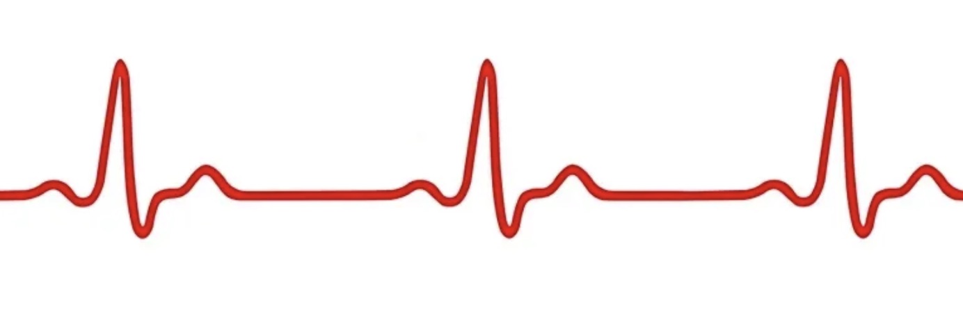 ECG 심전도 — 이 라인을 타임라인으로 쓰면 어떨까