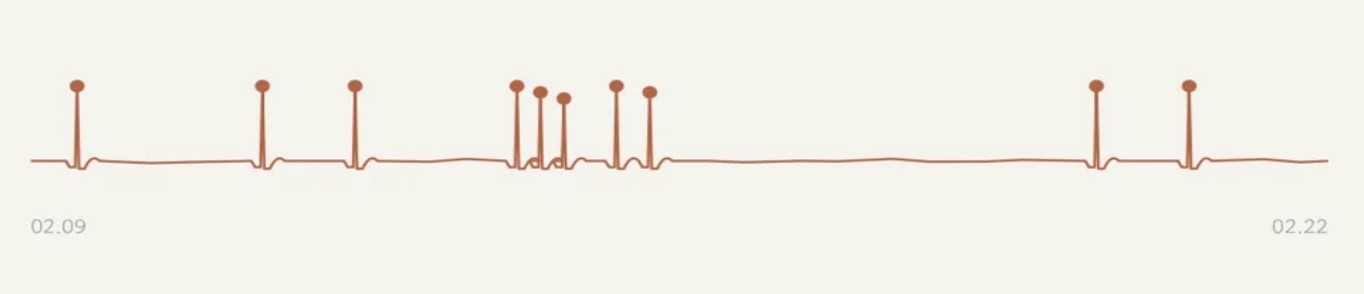 큐빅 베지어로 바꾼 뒤 — 피크마다 동그라미가 있던 중간 버전